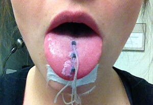 person's tongue with electrodes